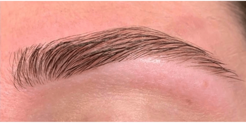 Behandlung Nachher – Beautybar Gersthofen